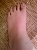 brianne foot 2.jpg