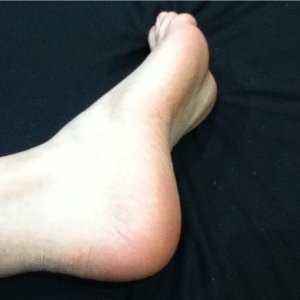 Foot