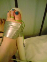 Tape toe trap x.jpg