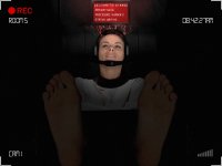 Patient ID54113 - Procedure Number 2 - Part 2.jpg