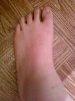 brianne foot 2.jpg