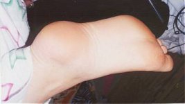 foot.jpg