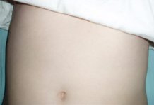 tickletummy2.JPG