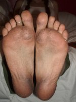 homeless lady feet (2112 x 2816).jpg