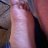 TickleWedgies95