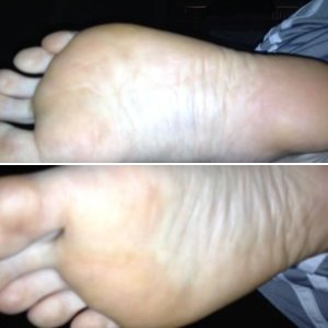 My Ticklish size 13's