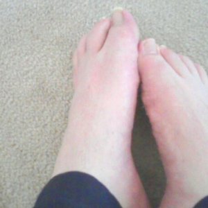 feet