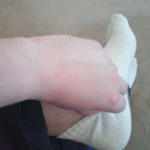 socktease