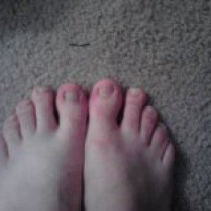 my feet