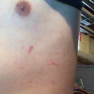 Some cuts from some knife play I did at a fetish party.