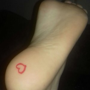They is my foot, I got attacked