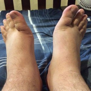 The tops of my feet.