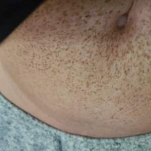 Tummy2