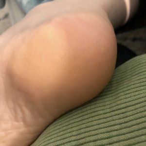 Proof of my heels. No dryness!