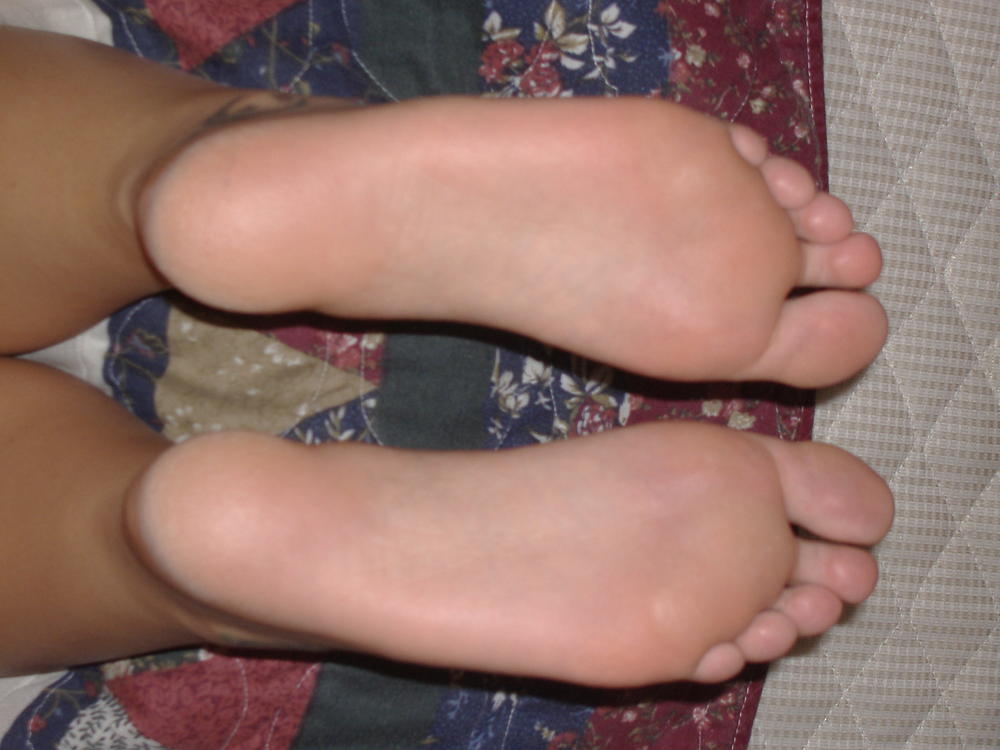 564