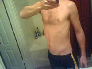 adpic