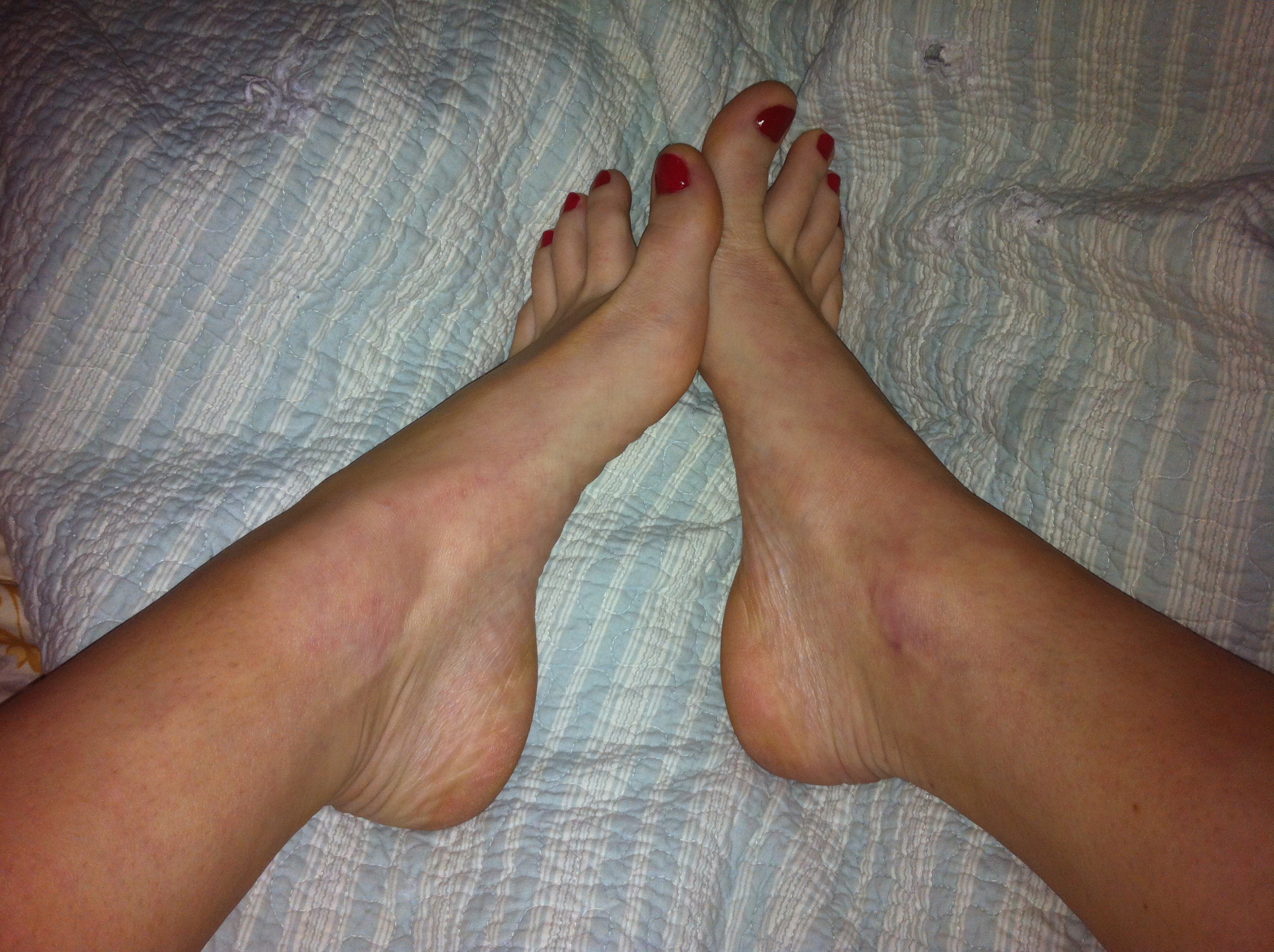 archesfeetphoto