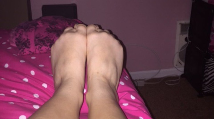 Curled Toes