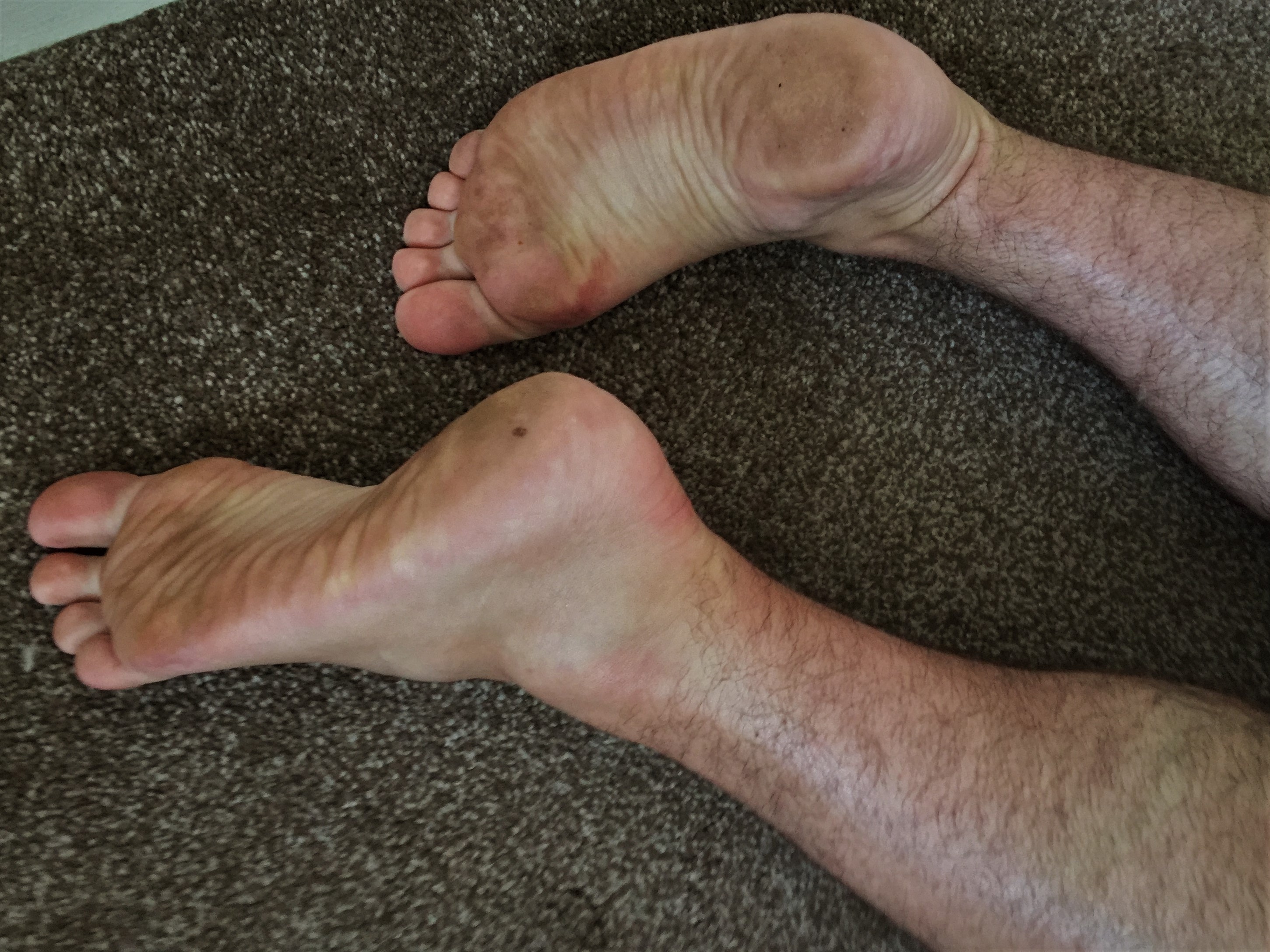 Dirty post bare foot run feet
