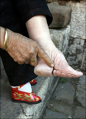 footbinding