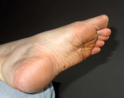 just felt like adding another foot photo.......