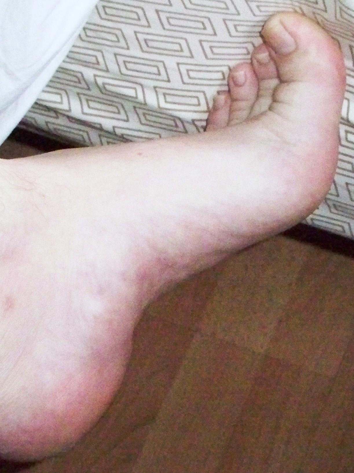 My arch