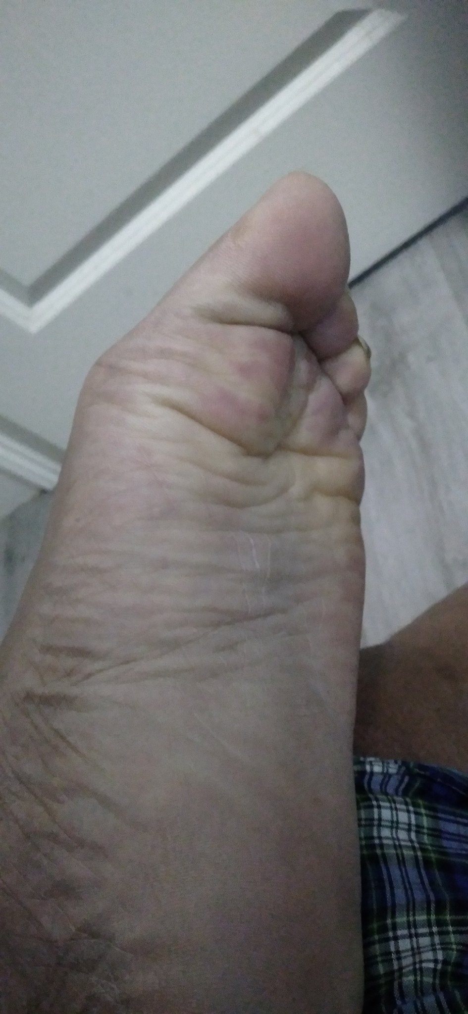 my extremely ticklish foot