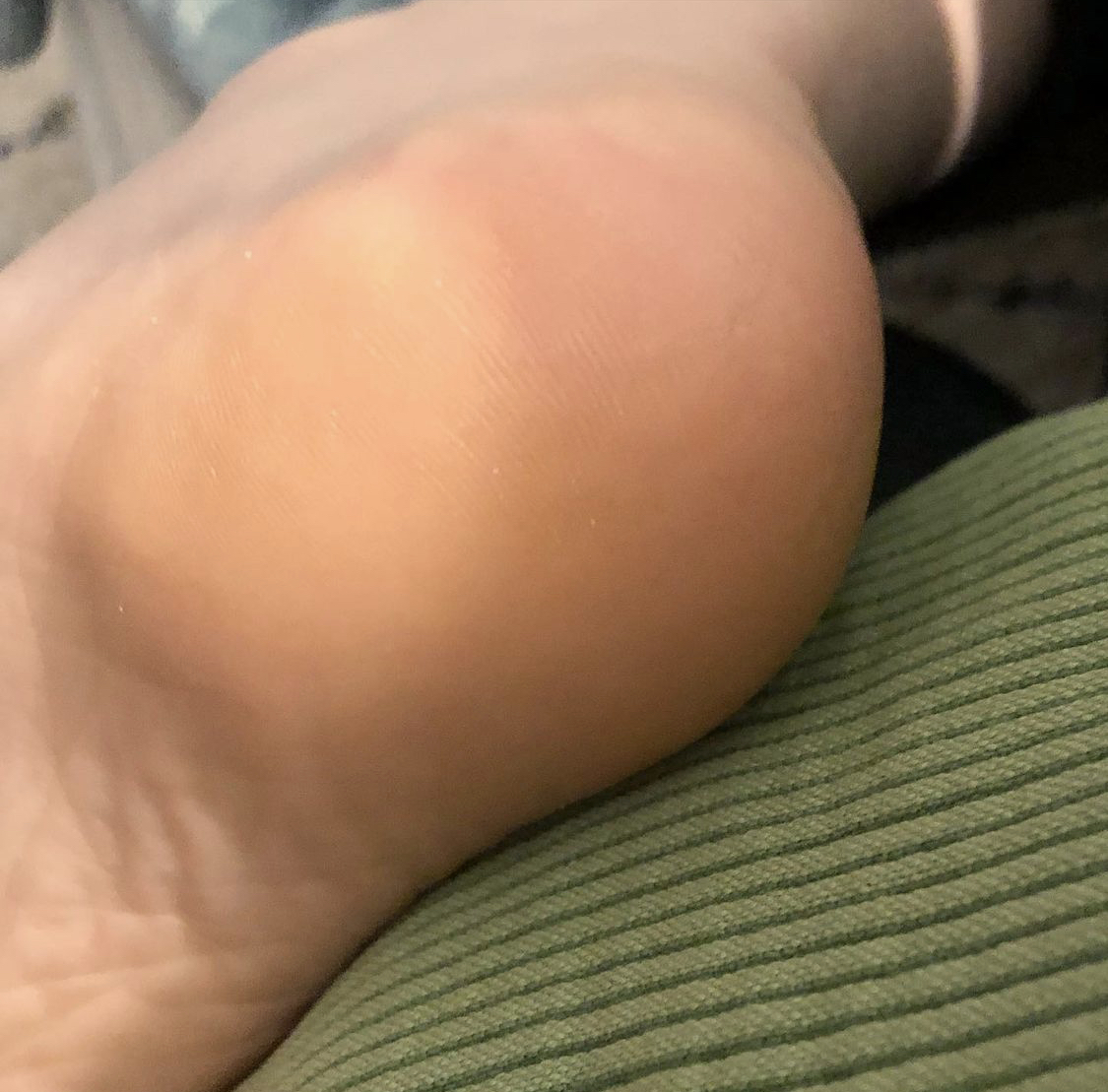 Proof of my heels. No dryness!