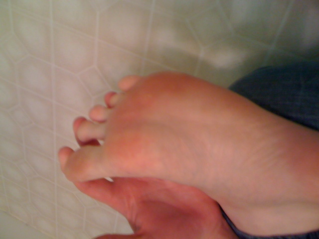 Soles 3
