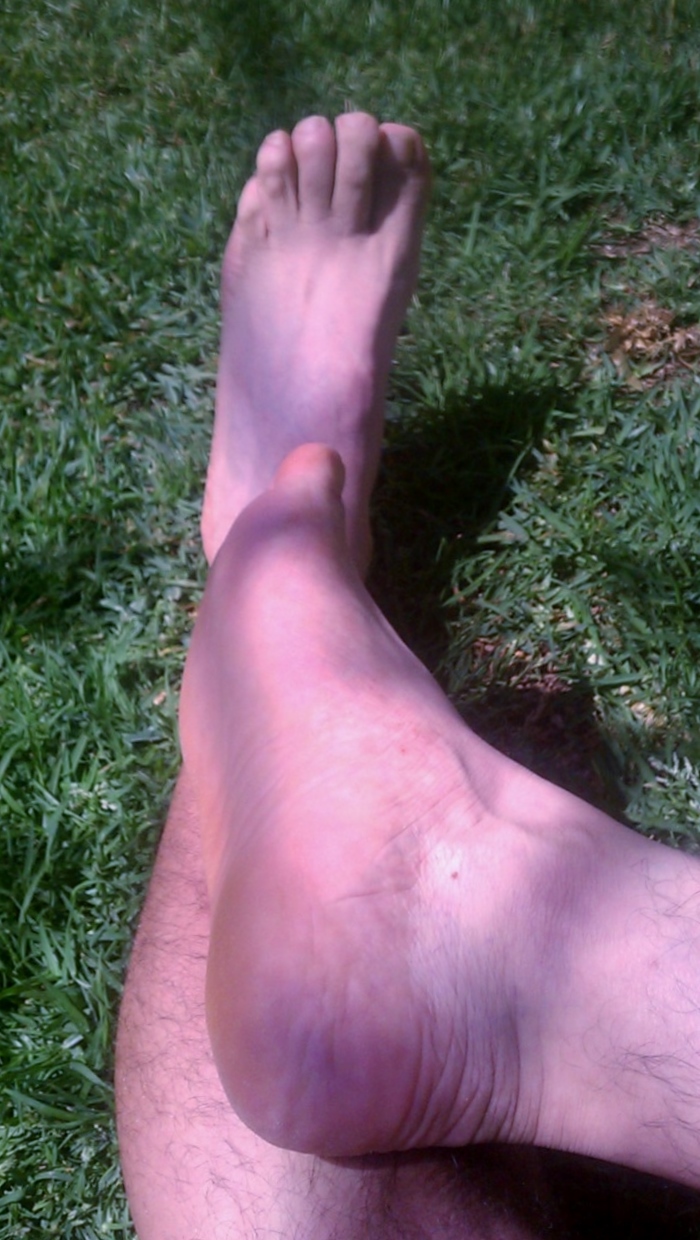 Ticklish Bare feet in the grass