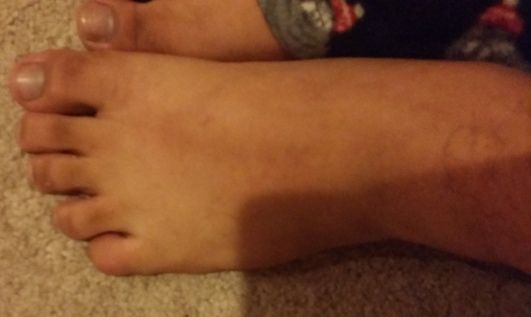 Top of foot