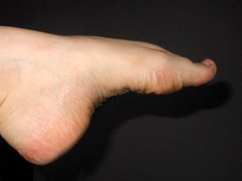 ......what's one more foot photo? lol