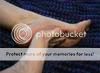 010_sole_and_toes_thumb.jpg