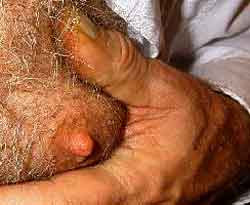 HairyNipple.jpg